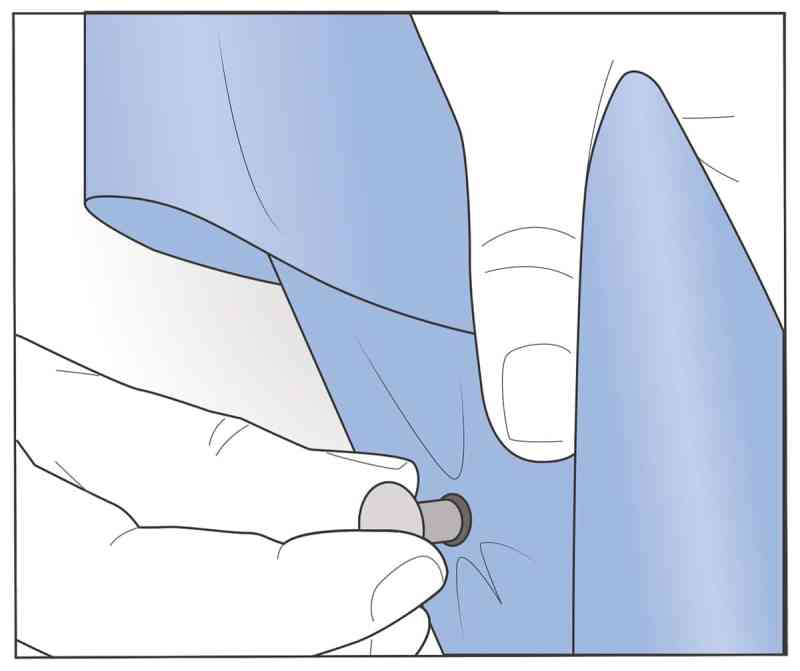 How to Repair Canvas Snaps on Boats
